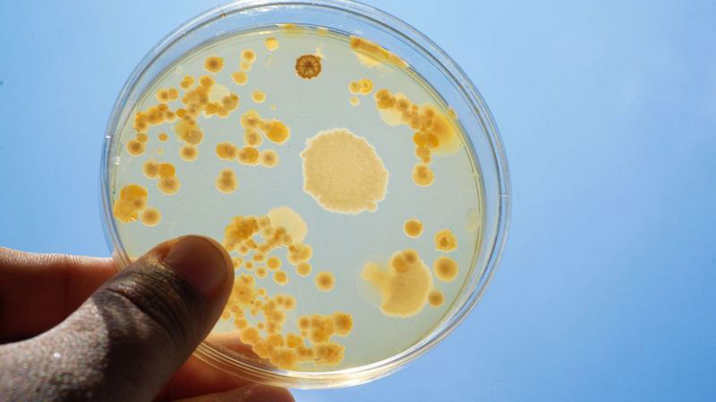 北京消泡劑-北京鄭小姐細菌發酵消泡劑使用和應用案例